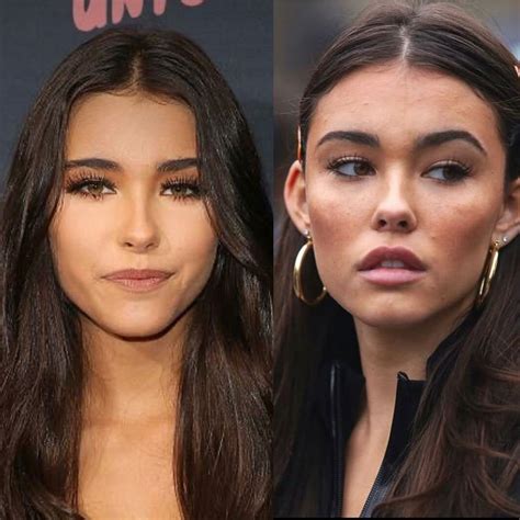 madison beer before plastic|Madison Beer: Before and After Surgery